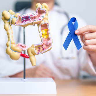 Photo shows a model of a human colon with a health care professional sitting behind it pointing at it with a pen and then a dark blue ribbon for colorectal cancer awareness.